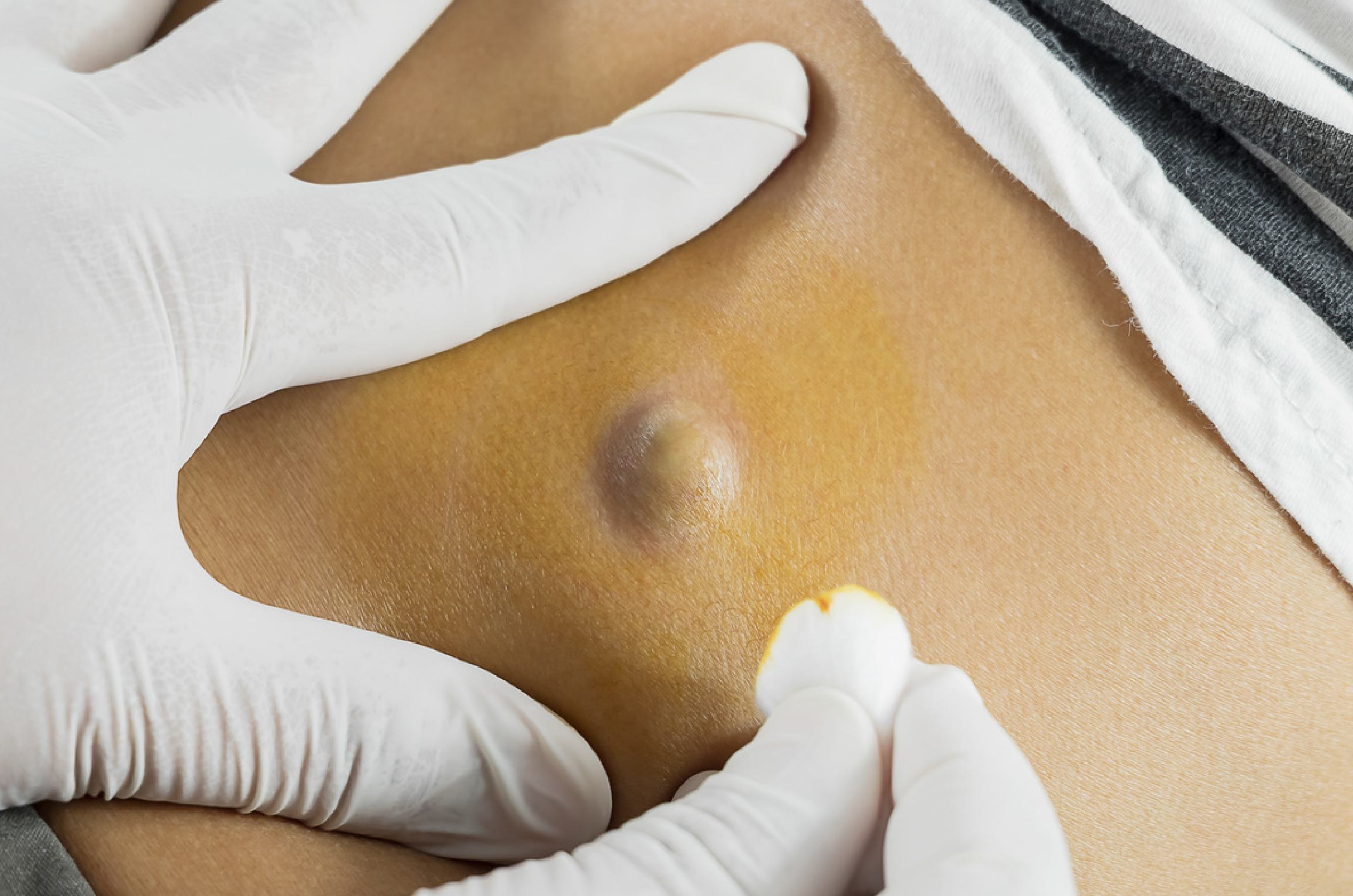 Dermashrii